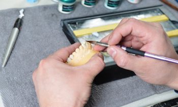 Crowns | Mountainside Dental Care | Oro Valley AZ